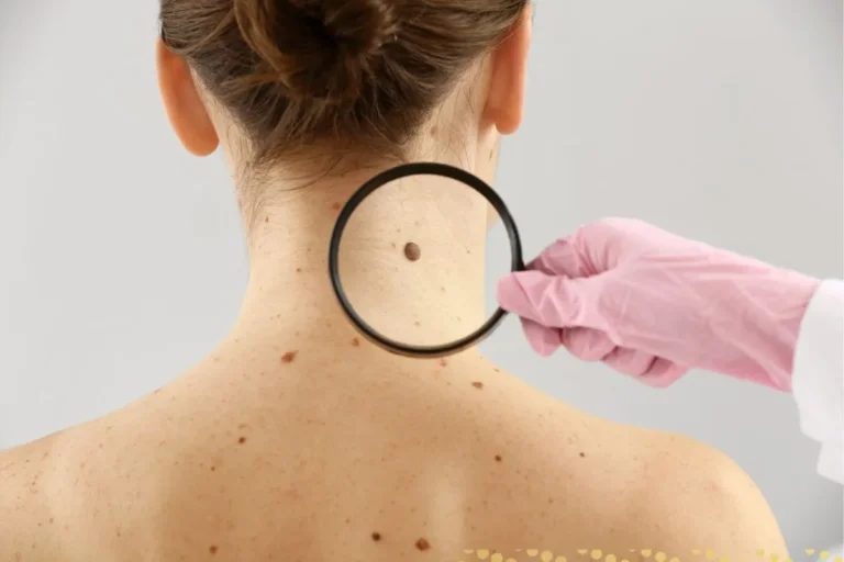 what-is-the-spiritual-meaning-of-mole-on-the-neck-for-males-and-females