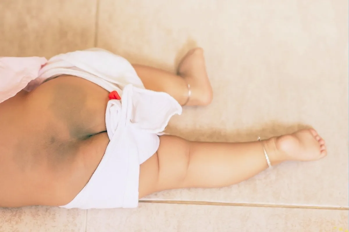 what-is-the-spiritual-meaning-of-buttock-birthmark-for-males-and-females