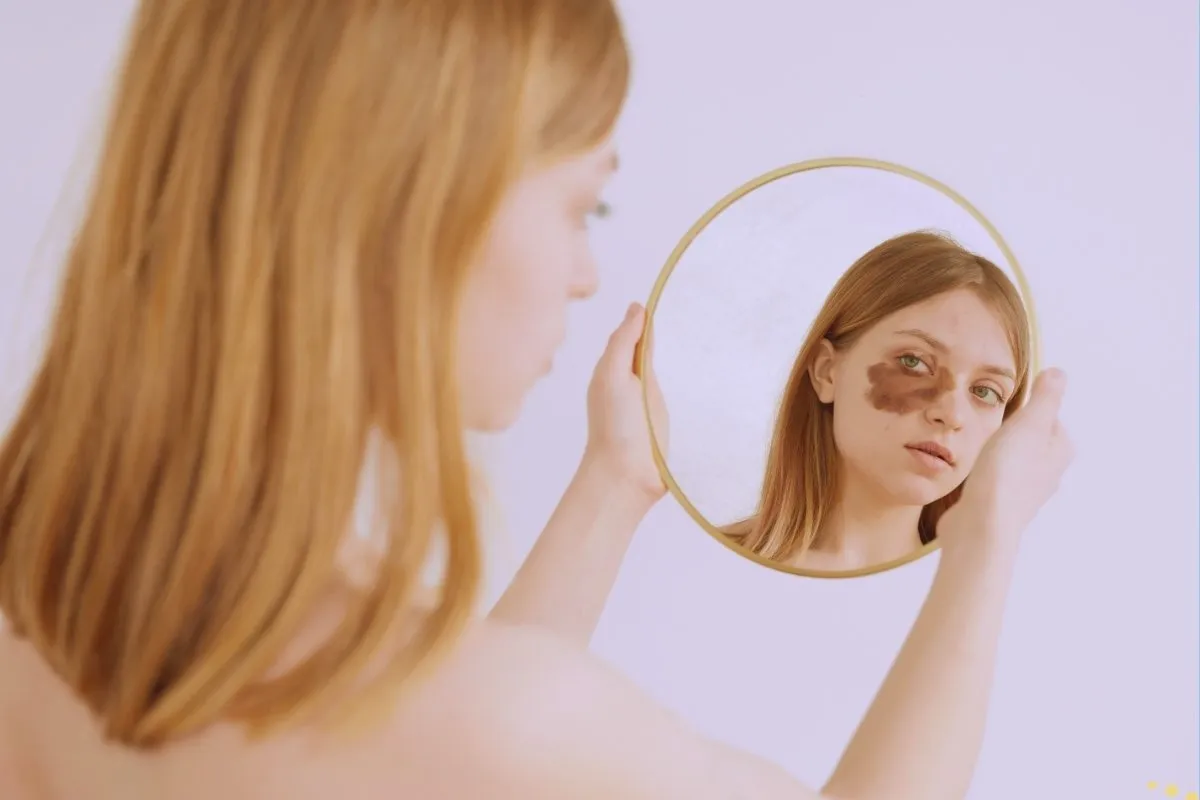 what-is-the-spiritual-meaning-of-royal-birthmark