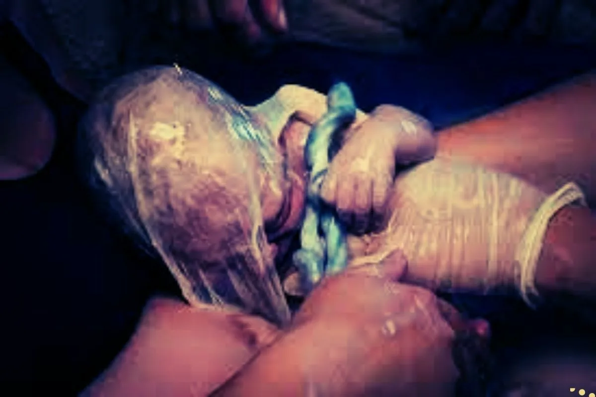 what-is-the-spiritual-meaning-of-veiled-or-en-caul-birth