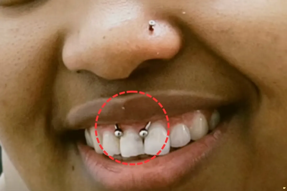spiritual-meaning-of-smiley-piercing