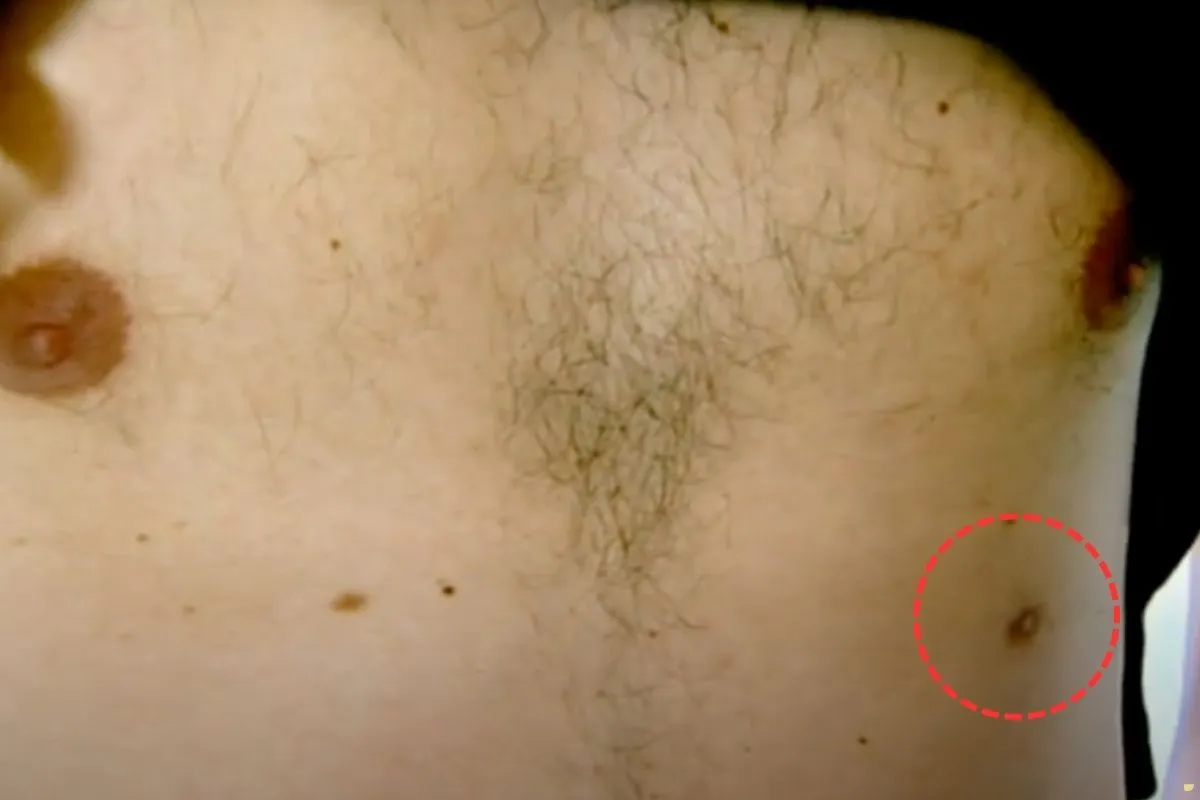 what-is-the-spiritual-meaning-of-third-nipple